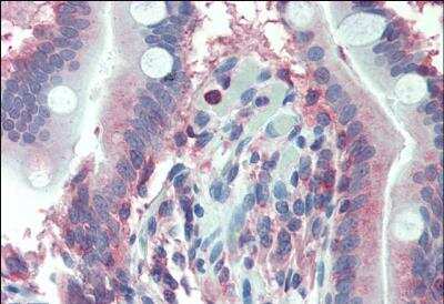 Immunohistochemistry-Paraffin: LASP1 Antibody [NB100-77338]
