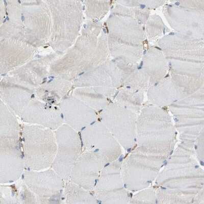 Immunohistochemistry-Paraffin: LASP1 Antibody [NBP1-82844]