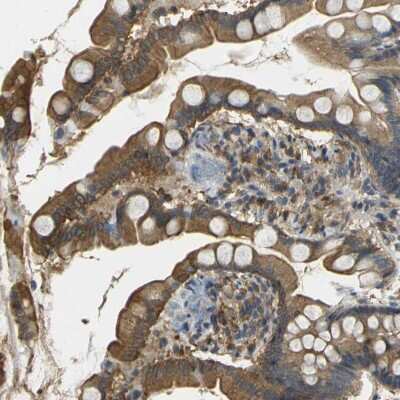 Immunohistochemistry-Paraffin: LASP1 Antibody [NBP1-82844]