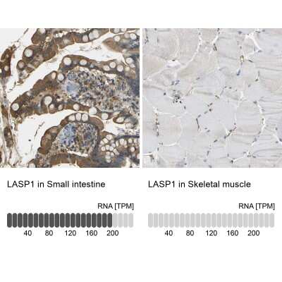 Immunohistochemistry-Paraffin: LASP1 Antibody [NBP1-82844]