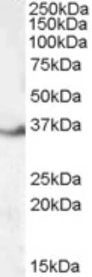 Western Blot: LASP1 Antibody [NB100-77338]