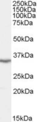 Western Blot: LASP1 Antibody [NB100-854]