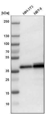 Western Blot: LASP1 Antibody [NBP1-82844]