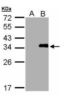 Western Blot: LASP1 Antibody [NBP2-19334]