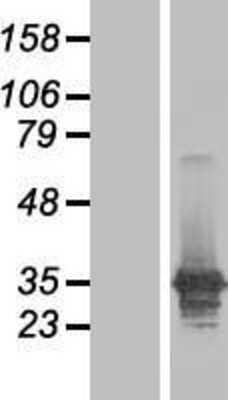 Western Blot: LASP1 Overexpression Lysate [NBP2-07659]