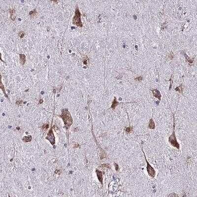 Immunohistochemistry-Paraffin: LASS1 Antibody [NBP1-92067]