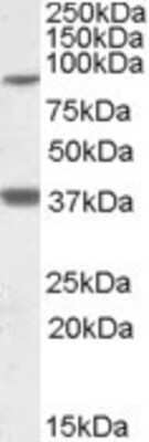 Western Blot: LASS1 Antibody [NBP1-28480]