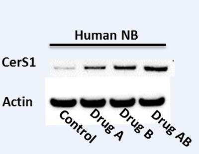 Western Blot: LASS1 Antibody [NBP1-59733]