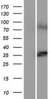 Western Blot: LASS1 Overexpression Lysate [NBP2-04711]