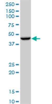 Western Blot: LASS2 Antibody (1A6) [H00029956-M01A]