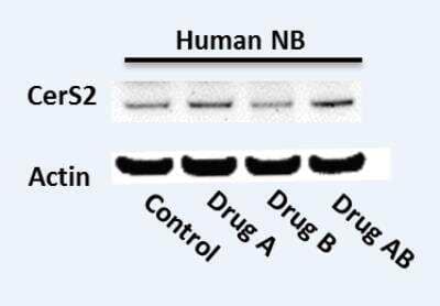 Western Blot: LASS2 Antibody (1A6) [H00029956-M01A]