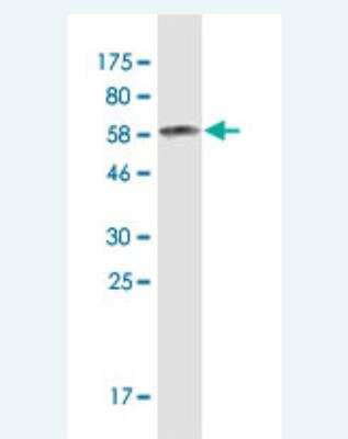 Western Blot: LASS2 Antibody (4D8) [H00029956-M10]