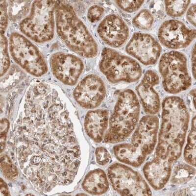 Immunohistochemistry-Paraffin: LASS2 Antibody [NBP1-84537]