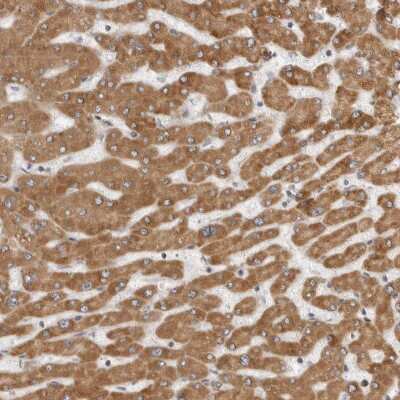 Immunohistochemistry-Paraffin: LASS2 Antibody [NBP1-84537]