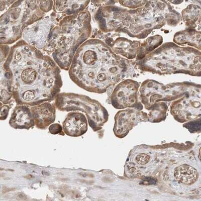 Immunohistochemistry-Paraffin: LASS2 Antibody [NBP1-84537]