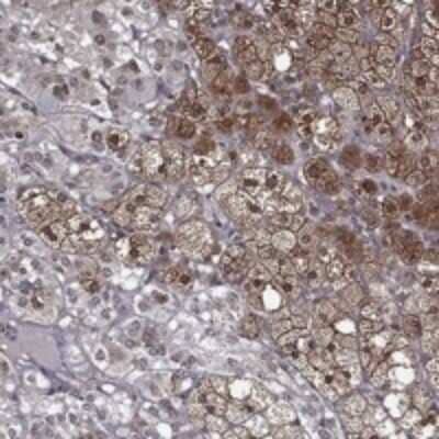 Immunohistochemistry-Paraffin: LASS2 Antibody [NBP3-17730]