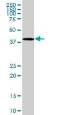 Western Blot: LASS2 Antibody [H00029956-B01P]