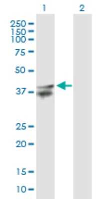 Western Blot: LASS2 Antibody [H00029956-B01P]