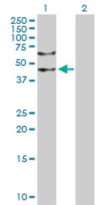 Western Blot: LASS2 Antibody [H00029956-D01P]