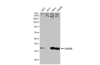 Western Blot: LASS2 Antibody [NBP3-12946]