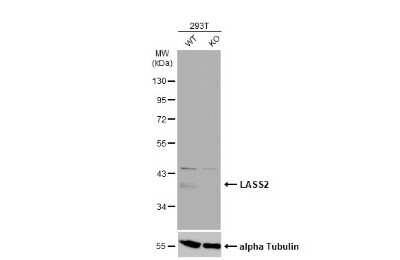 Western Blot: LASS2 Antibody [NBP3-12946]