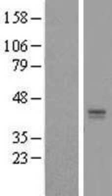 Western Blot: LASS2 Overexpression Lysate [NBL1-12441]