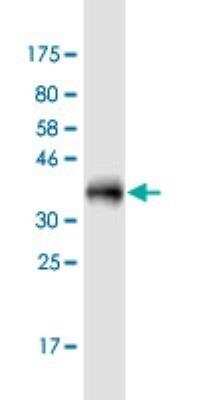 Western Blot: LASS3 Antibody (6C12) [H00204219-M02-100ug]