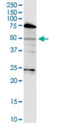 Western Blot: LASS3 Antibody (6C12) [H00204219-M02-100ug]