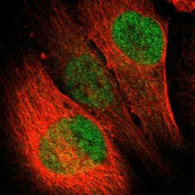 Immunocytochemistry/ Immunofluorescence: LASS3 Antibody [NBP1-84536]