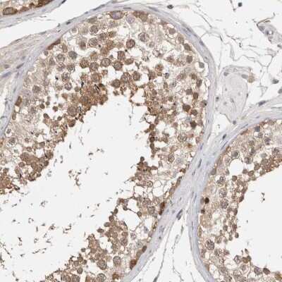Immunohistochemistry-Paraffin: LASS3 Antibody [NBP1-84535]