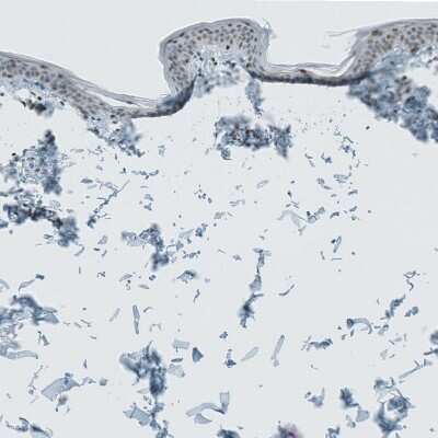 Immunohistochemistry-Paraffin: LASS3 Antibody [NBP1-84536]