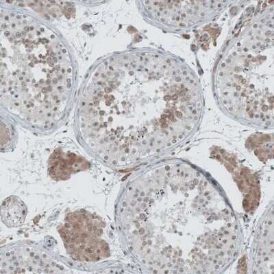 Immunohistochemistry-Paraffin: LASS3 Antibody [NBP1-84536]