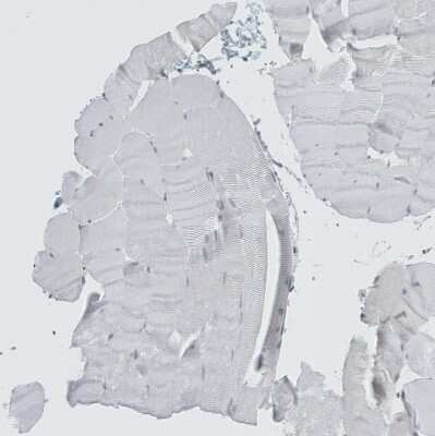 Immunohistochemistry-Paraffin: LASS3 Antibody [NBP1-84536]