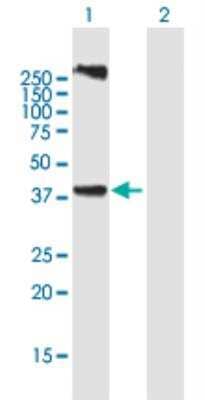 Western Blot: LASS3 Antibody [H00204219-B01P-50ug]