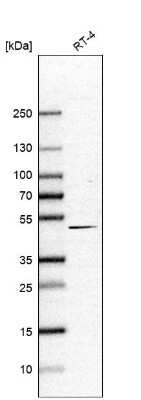 Western Blot: LASS3 Antibody [NBP1-84535]