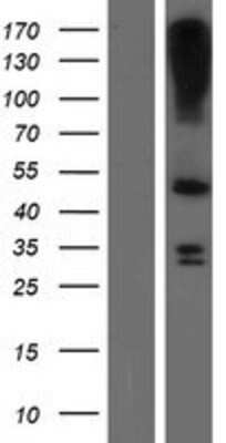 Western Blot: LASS3 Overexpression Lysate [NBP2-04946]