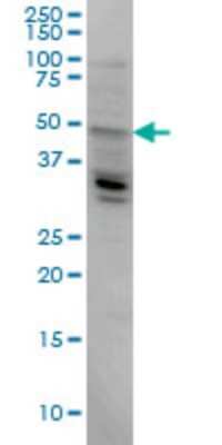 Western Blot: LASS4 Antibody (2G6) [H00079603-M04]