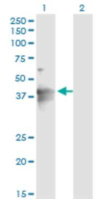 Western Blot: LASS4 Antibody (4B10) [H00079603-M02]