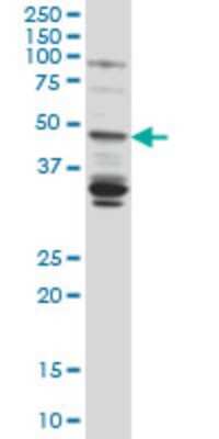 Western Blot: LASS4 Antibody (7D1) [H00079603-M01]