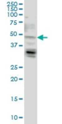 Western Blot: LASS4 Antibody (7D5) [H00079603-M03]