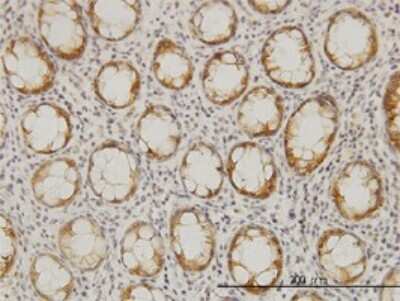 Immunohistochemistry-Paraffin: LASS6 Antibody (5H7) [H00253782-M01]