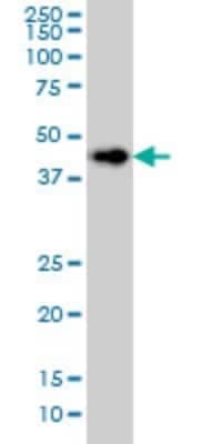 Western Blot: LASS6 Antibody (5H7) [H00253782-M01]