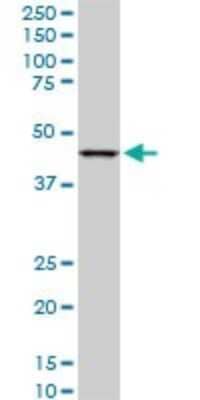 Western Blot: LASS6 Antibody (6B8) [H00253782-M02]