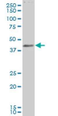 Western Blot: LASS6 Antibody [H00253782-A01]