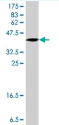 Western Blot: LASS6 Antibody [H00253782-A01]