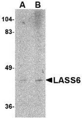 Western Blot: LASS6 AntibodyBSA Free [NBP1-76965]