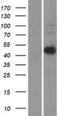 Western Blot: LASS6 Overexpression Lysate [NBP2-04549]