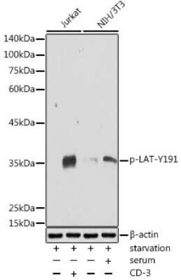 Western Blot: LAT [p Tyr191] AntibodyAzide and BSA Free [NBP3-16940]