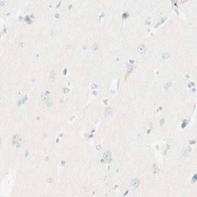 Immunohistochemistry-Paraffin: LAT Antibody [NBP1-81324]