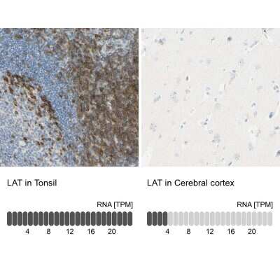 Immunohistochemistry-Paraffin: LAT Antibody [NBP1-81324]